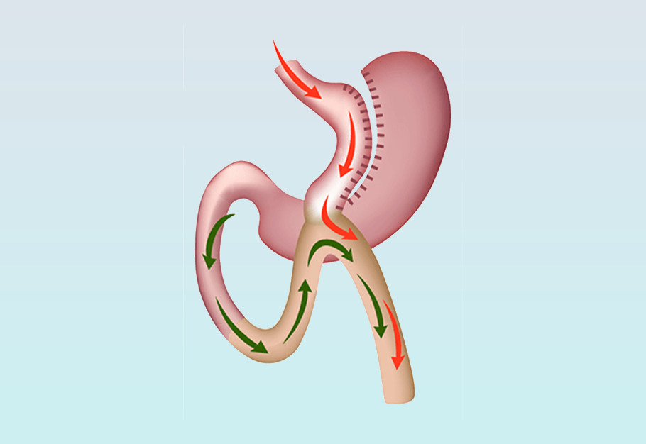 عمليات تحويل المسار